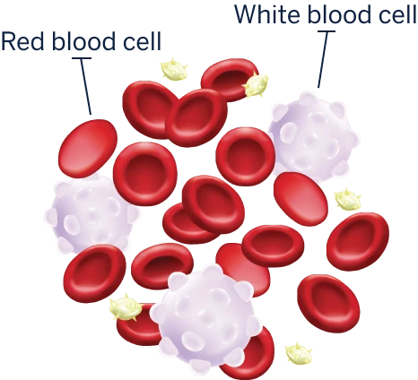 A graphic showing red blood cells mixed with white blood cells in normal blood.